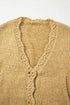Delicate Scallop Edge V Neck Button Down Cozy Knit Cardigan