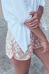 Leopard Print Arched Hem Elastic Waist Casual Shorts